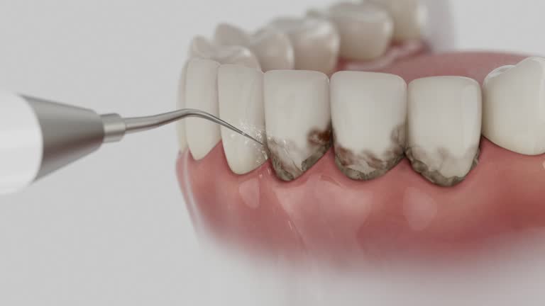 Reliable Dental Implants contractor in Pevely, MO by Smile Center Dentistry